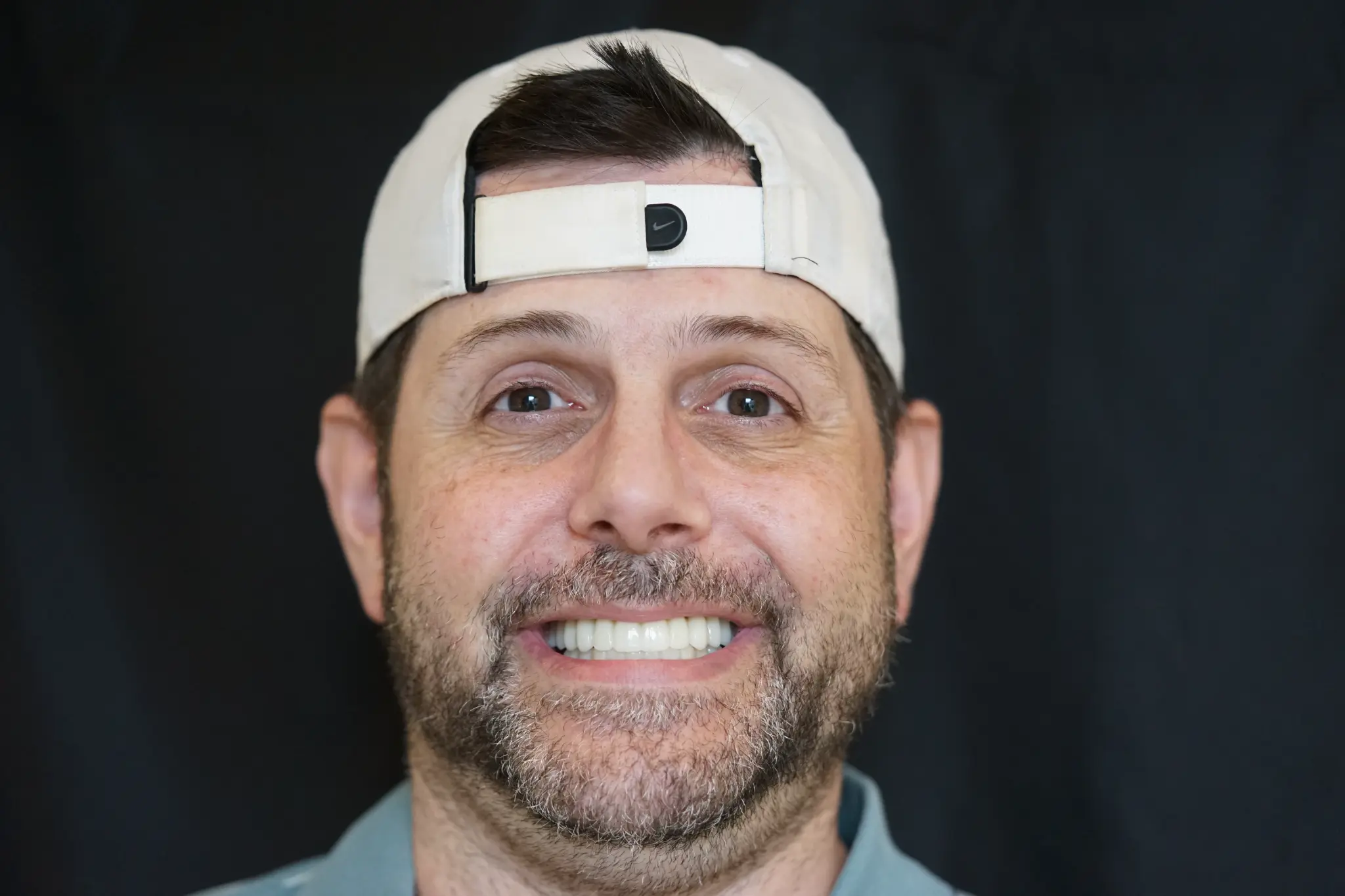 After All-on-X treatment - complete smile restoration